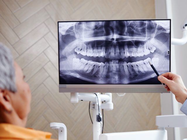 Boronia-Heights-Family-Dental-general-services-xray-consultation